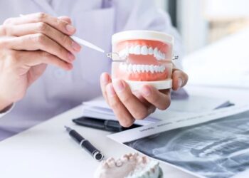 Everything You Need to Know About Porcelain Veneers