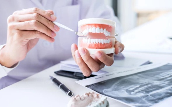 Everything You Need to Know About Porcelain Veneers