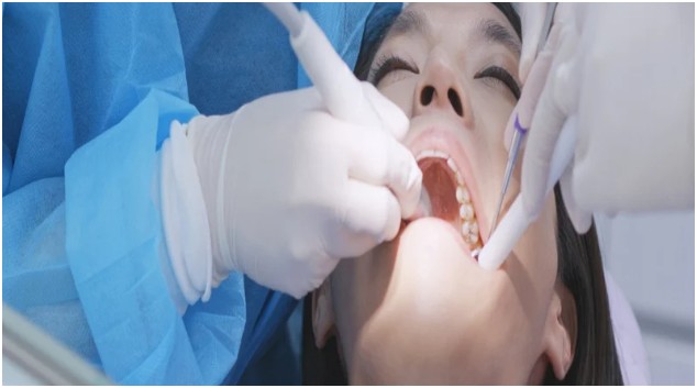 Professional Cleaning Aids Gum Health