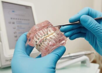 Why More Patients Are Asking About Quicker Orthodontic Solutions